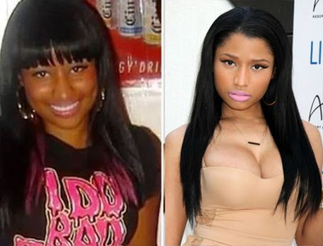 A before and after picture of Minaj regardging her plastic surgery.